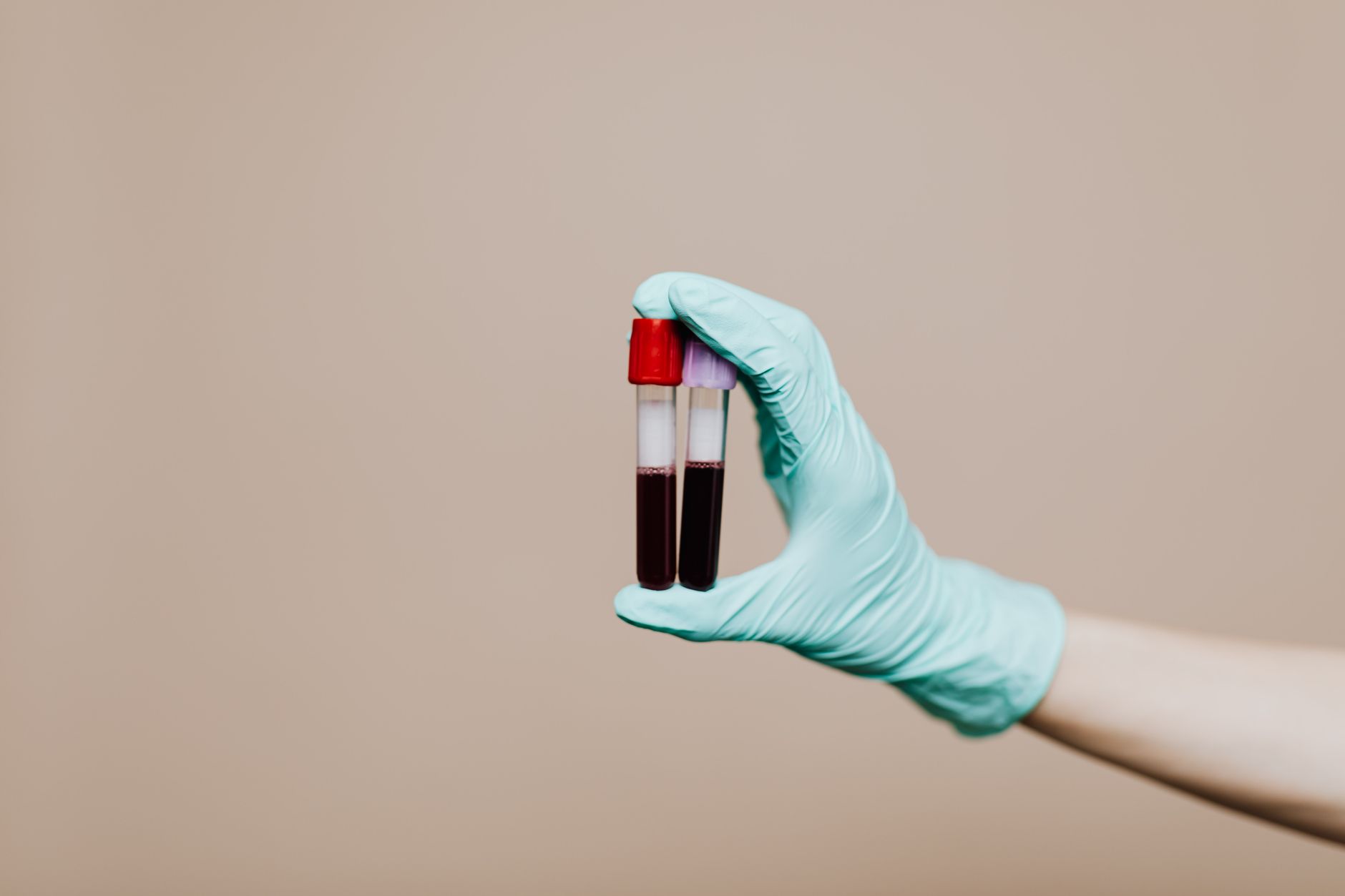 Soil Test Kit: Complete Buying and Using Guide